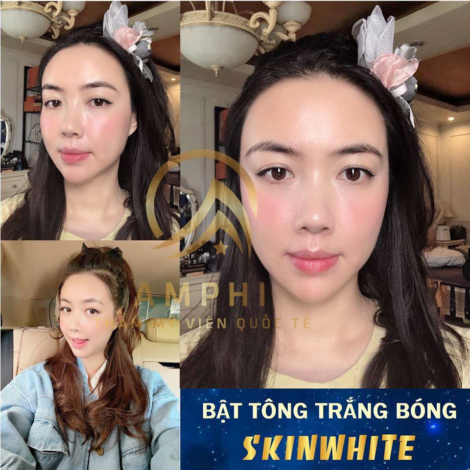 chăm sóc da tại thẩm mỹ viện AmPhi