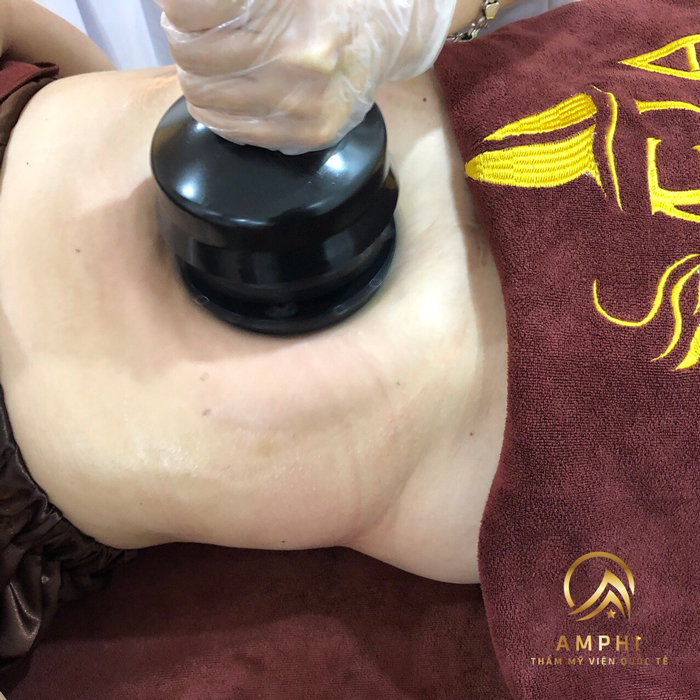 khách hàng giảm béo tại AmPhi