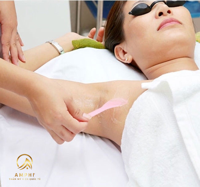 khách hàng triệt lông tại AmPhi