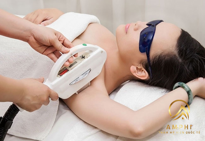 khách hàng triệt lông tại AmPhi