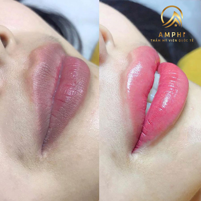 Phun xăm thẩm mỹ tại Amphi