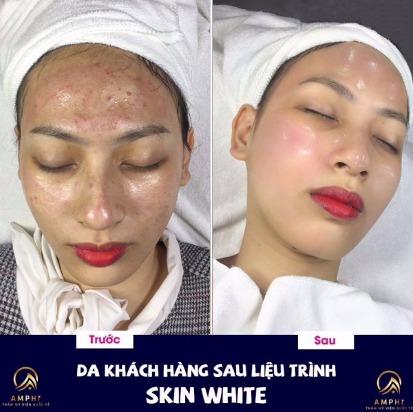 CHỊ MAI AN - CHĂM SÓC DA NÂNG CAO SKIN WHITE