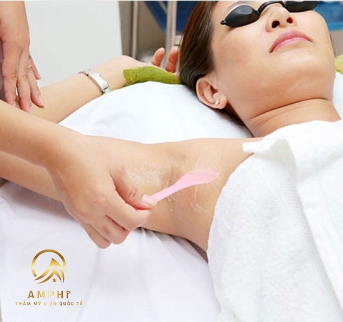 Triệt lông ERA tại Thẩm mỹ viện Amphi