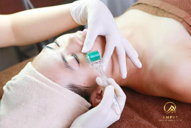 Phi kim trị mụn, những điều phải biết trước khi phi kim Phi kim trị mụn, những điều phải biết trước khi phi kim