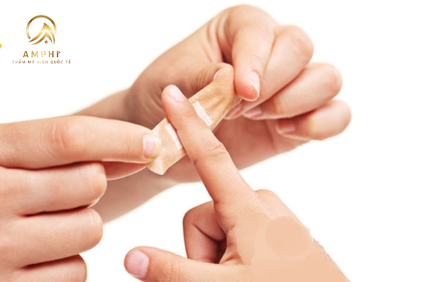 tẩy nốt ruồi kiêng nước mấy ngày