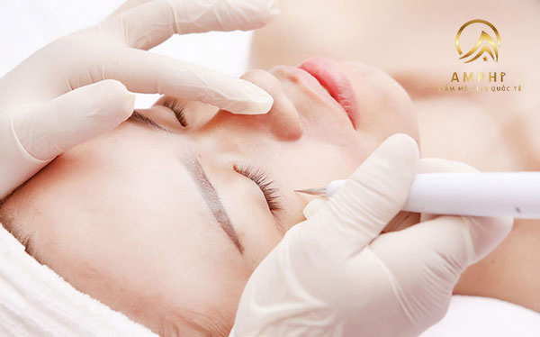 Bạn có biết tẩy nốt ruồi kiêng nước mấy ngày không?