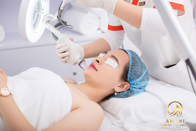 trị mụn bằng laser