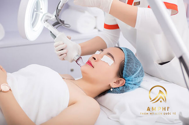 trị nám bằng laser có hết không