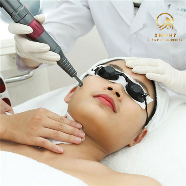 Trị nám bằng laser có hết không? Tìm hiểu kỹ trước khi tiền mất tật mang Trị nám bằng laser có hết không? Tìm hiểu kỹ trước khi tiền mất tật mang