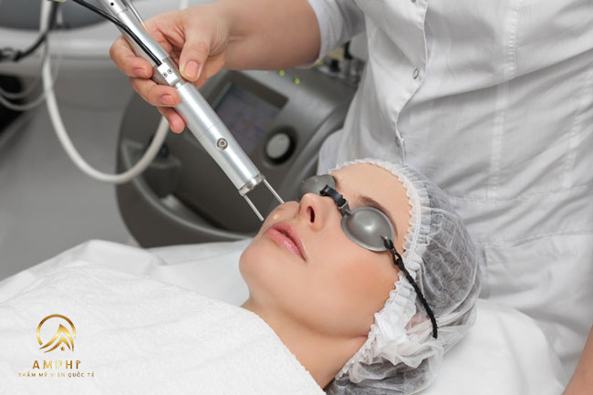 trị nám bằng laser ở đâu tốt nhất