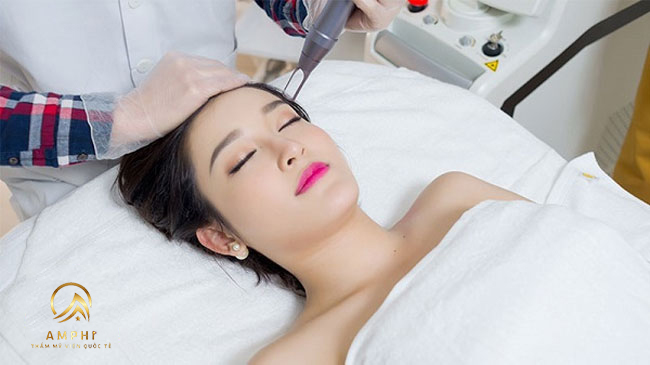 trị nám bằng laser