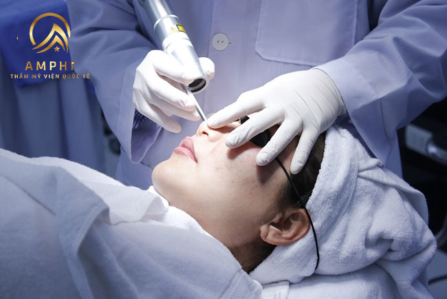 Trị nám bằng laser là gì, có thực sự hiệu quả và an toàn? Trị nám bằng laser là gì, có thực sự hiệu quả và an toàn?