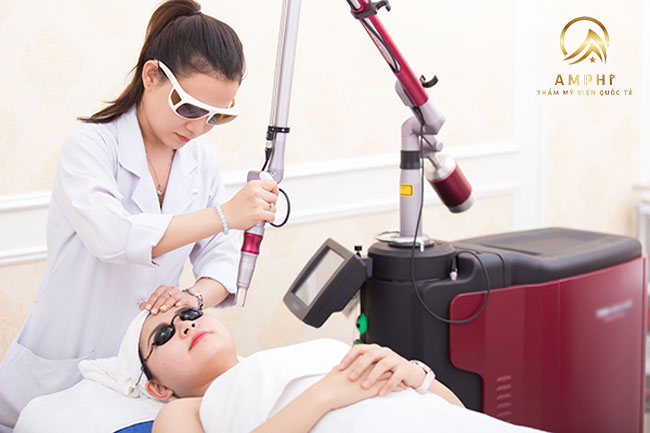 Trị nám giá bao nhiêu? Bật mí địa chỉ trị nám tốt nhất