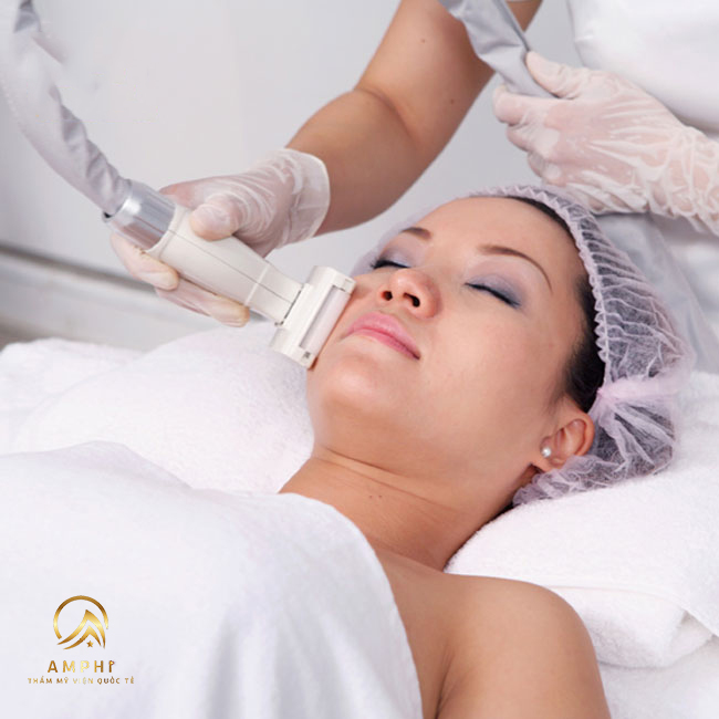 Trị nám tại spa nên hay không? Nên trị nám tại nhà hay đi spa?