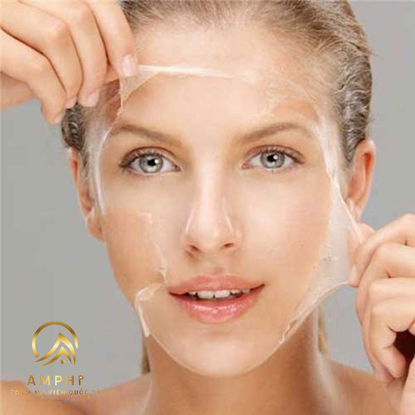 cách chăm sóc da sau khi peel