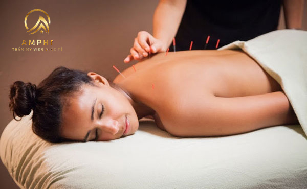 châm cứu giảm béo