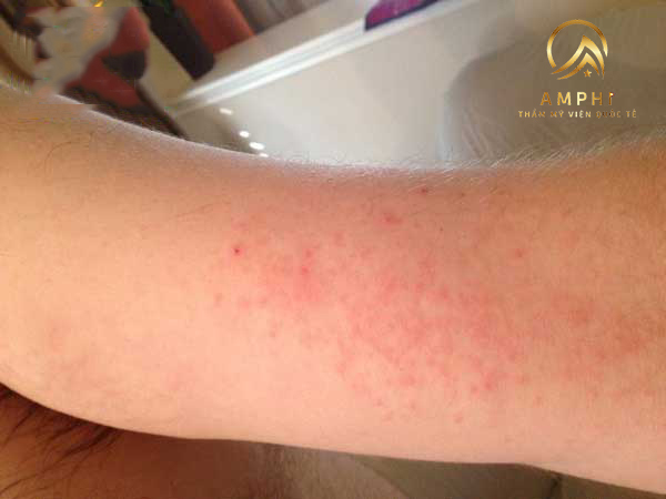 cách chăm sóc da sau khi wax lông