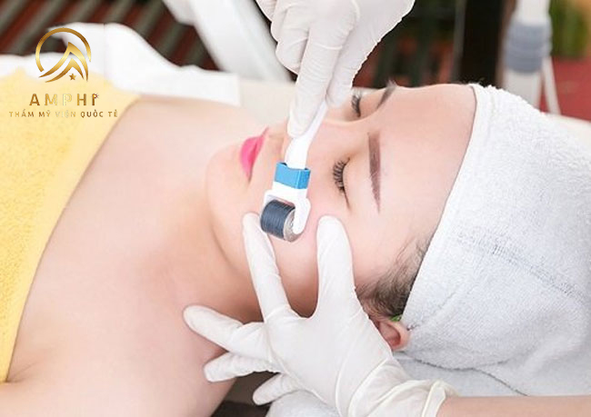 Có nên lăn kim trị sẹo không? Lăn kim trị sẹo có tốt không? Có nên lăn kim trị sẹo không? Lăn kim trị sẹo có tốt không?