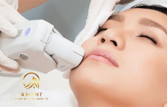 công nghệ triệt lông vĩnh viễn