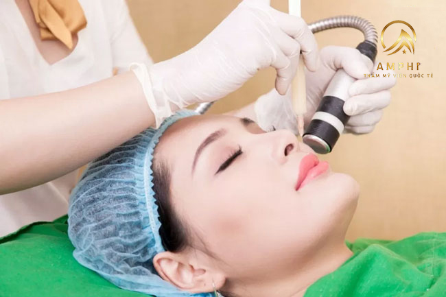 Lăn kim trị sẹo bao nhiêu tiền? Nên lựa chọn Spa nào để thực hiện? Lăn kim trị sẹo bao nhiêu tiền? Nên lựa chọn Spa nào để thực hiện?