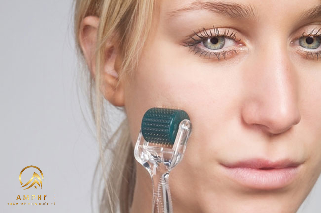 Đừng lăn kim trị sẹo rỗ tại nhà nếu bạn chưa biết những điều sau Đừng lăn kim trị sẹo rỗ tại nhà nếu bạn chưa biết những điều sau