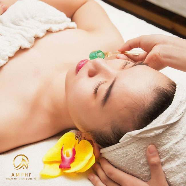 lăn kim trị sẹo