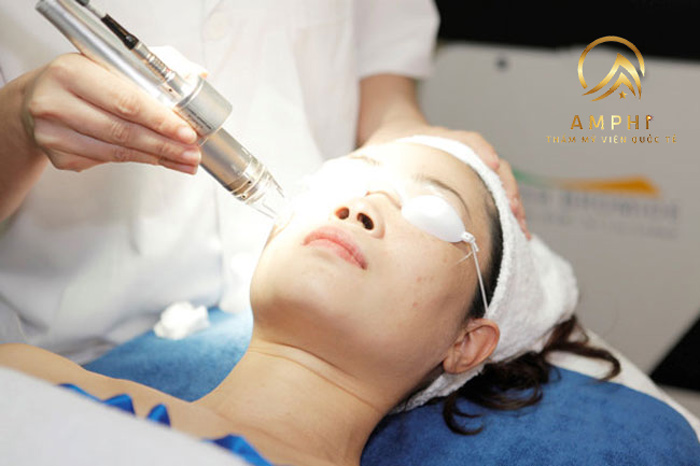 laser co2 trị sẹo lõm