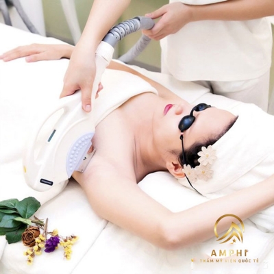 Công nghệ triệt lông vĩnh viễn mới nhất hiện nay