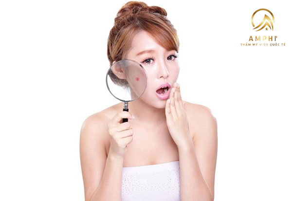 trị mụn cho da dầu