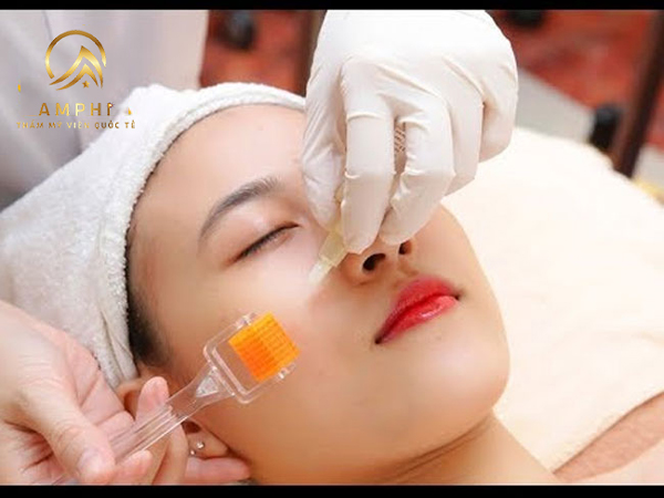 trị sẹo lõm bằng lăn kim