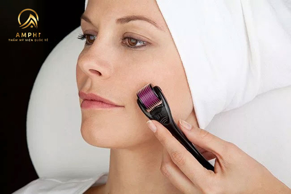 trị sẹo lõm bằng lăn kim